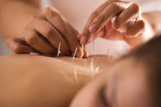Can Acupuncture Cure Herpes? We Summarize The Science - Health Beyond Hype