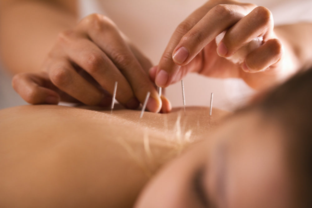 Can Acupuncture Cure Herpes? We Summarize The Science